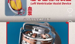 【深度】国产人工心的商业暗战|界面新闻