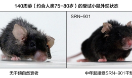 每月3000元买长寿：衰老抑制剂瑞拓龄走红，长寿药为何不再是天方夜谭？|界面新闻